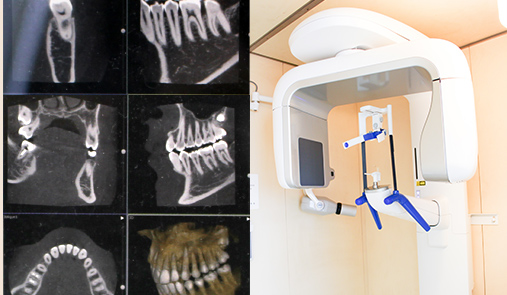 歯科用CT
